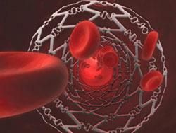 red blood cells with stint shown